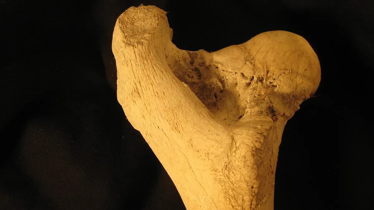 Kalça ve uyluk kemiğinin anatomik gösterimi
